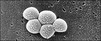 An electron micrograph shows five light grey spherical bacterial cells clustered together on a dark grey flat surface.