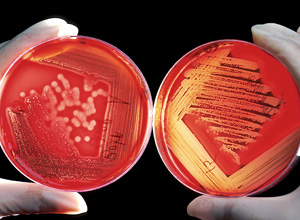 A photograph shows two petri dishes side by side against a black background. The cultures growing on both dishes have been inoculated using variations of a technique called the quadrant streak. In the plate at left, a stick-like tool covered in cells has been dragged several times from left to right along one quarter of the plate to form several horizontal, parallel streaks. A fresh tool has dragged cells located at the end of the first quadrant through a second, vertical quadrant in an identical, streaking pattern. The cells at the end of the third quadrant were used to streak the fourth quadrant, diluting the initial cell inoculum enough to produce easily-identifiable colonies, which look like fuzzy circles growing at the end of the fourth quadrant and in the plate’s center. In the plate at right, the cells from the third quadrant were used to make zig-zagging streaks in the center of the plate. Large, distinct colonies are not visible in the plate at right.
