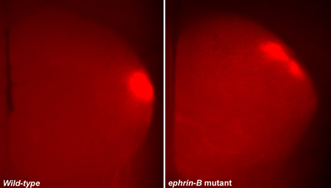 Two side-by-side color photomicrographs show axon projections in the superior colliculus of wild-type and ephrin-B mutant mice. RGC (retinal ganglion cell) axons were traced from a small region in the retina where the lipophilic dye Dil was injected. The superior colliculus of the wild-type mouse is shown at the left. The axon projections of the wild-type mouse are seen clustered together in a single location, where they form a single, fluorescent-red circle. The superior colliculus of the ephrin-B mutant mouse is shown at the right. The axon projections of the ephrin-B mutant mouse show a more disordered pattern and form two red, fluorescent spots with irregular borders. Together, the spots resemble a lopsided figure eight.