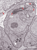 An electron micrograph shows a cross-section of a Toxoplasma gondii cell. The nucleus, golgi apparatus, apicoplast, rhoptry bulbs, rhoptry necks, apical cytoskeleton, micronemes, and parasitopherous vacuole membrane are labeled.