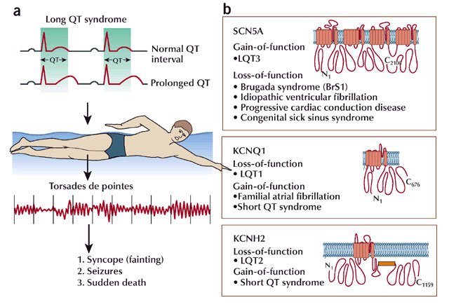 Panel A of this two-part diagram shows how a cardiac event may be triggered in a person with long QT syndrome. In panel B, three illustrated textboxes show the three ion channels responsible for most long QT cases, which include SCN5A, KCNQ1, and KCNH2. The textboxes list several other heritable arrhythmias that are caused by loss-of-function or gain-of-function mutations in each of these three channels.