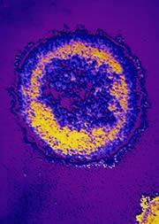 The HIV virus infected around 5 million people last year.