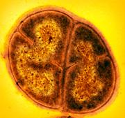 Deinococcus radiodurans survives extreme blasts of radiation.