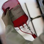 Blood banks don't have a way to test for abnormal prions, which could spread vCJD.