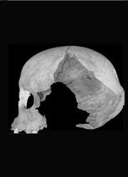 This skull, from a Romanian cave, shows signs of both Neanderthal and modern man.