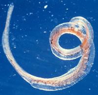 Parasites such as this adult male whipworm (Trichuris trichiura) could help treat people suffering from MS.