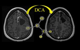 Experimental Cancer Drug Resurfaces Nature News