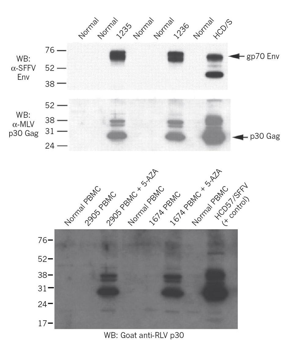 A figure (top), originally published in Science, was differently labelled (bottom) when reused in a presentation by Judy Mikovits.