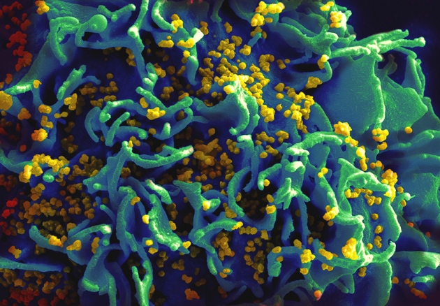 Hiv Overcomes Crispr Gene Editing Attack Nature News Comment