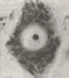 In this micrograph of a motor neuron nucleus, the nucleolus appears as a dark circle at the center of the nucleus against a gray background. The nucleolar satellite is absent.